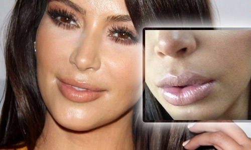 Ким Кардашьян и новые губы